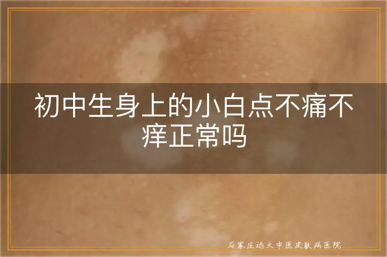 初中生身上的小白点不痛不痒正常吗