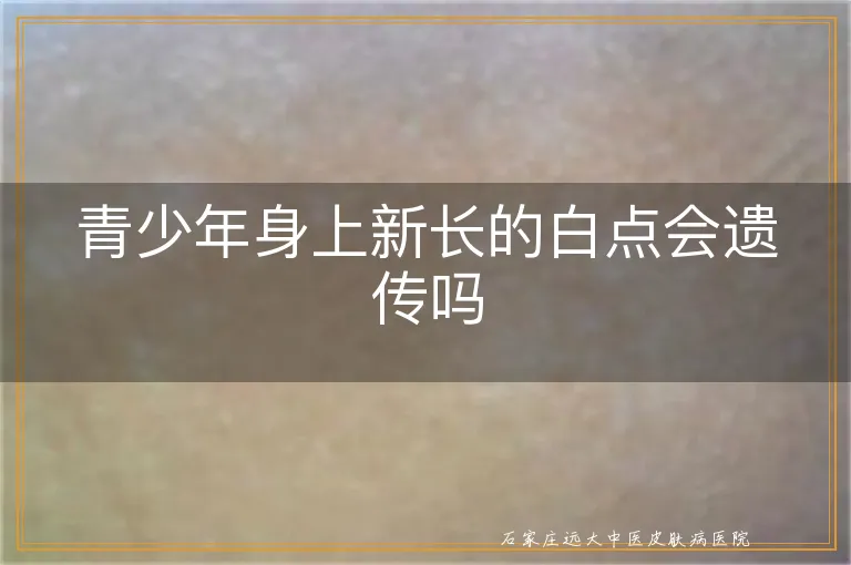 青少年身上新长的白点会遗传吗