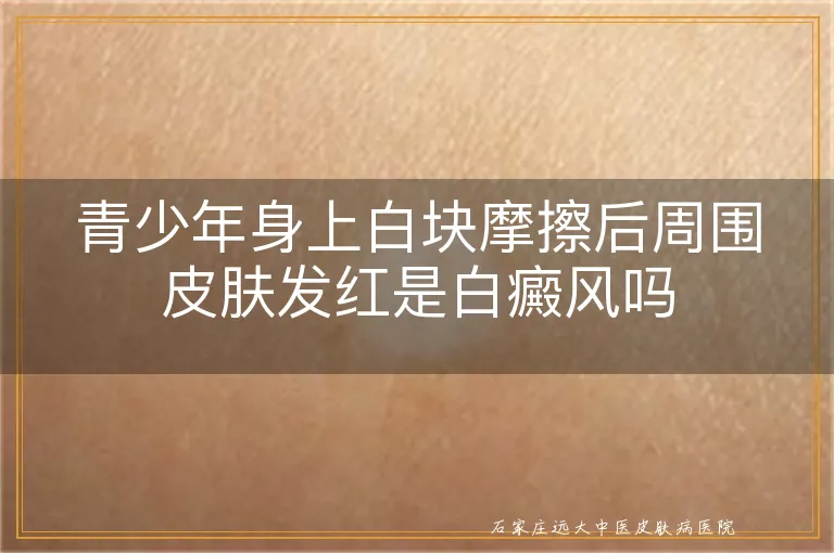 青少年身上白块摩擦后周围皮肤发红是白癜风吗