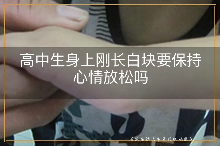 高中生身上刚长白块要保持心情放松吗