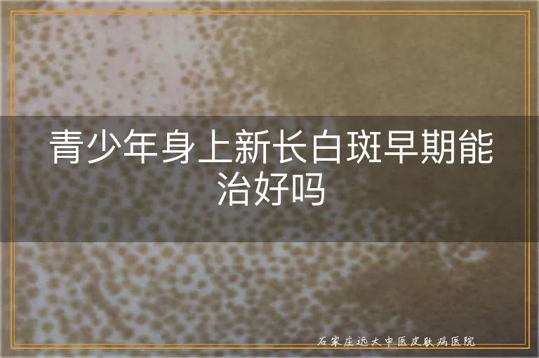 青少年身上新长白斑早期能治好吗