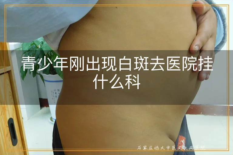 青少年刚出现白斑去医院挂什么科