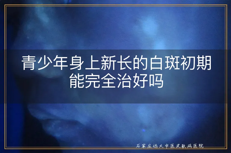 青少年身上新长的白斑初期能完全治好吗