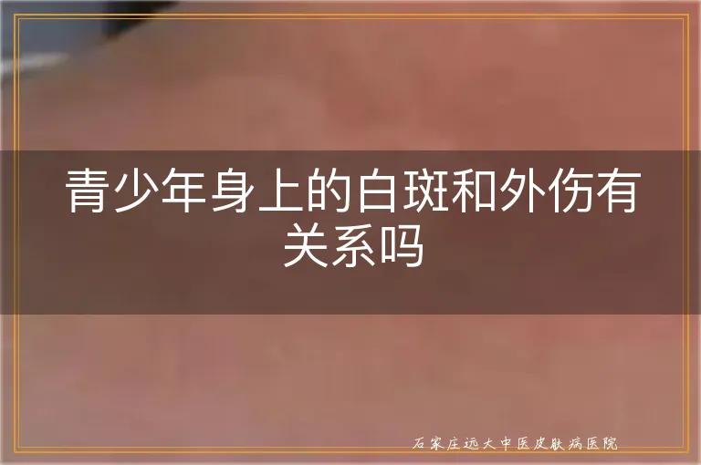 青少年身上的白斑和外伤有关系吗