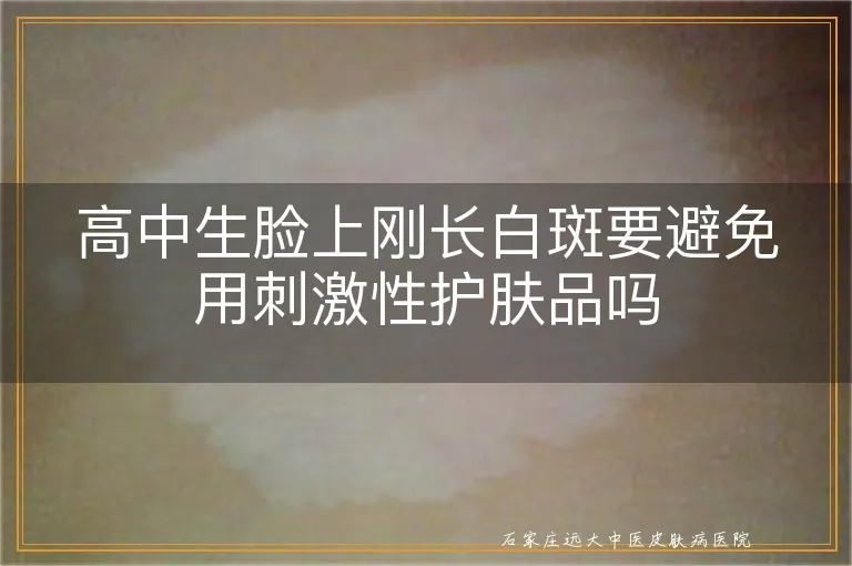 高中生脸上刚长白斑要避免用刺激性护肤品吗