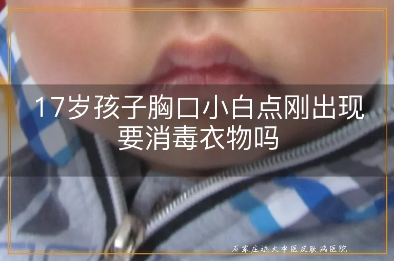 17岁孩子胸口小白点刚出现要消毒衣物吗