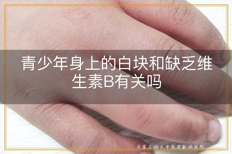 青少年身上的白块和缺乏维生素B有关吗