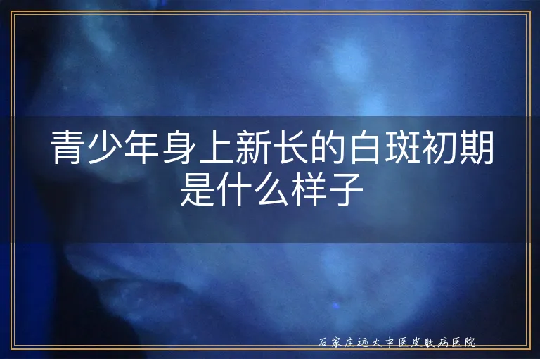 青少年身上新长的白斑初期是什么样子