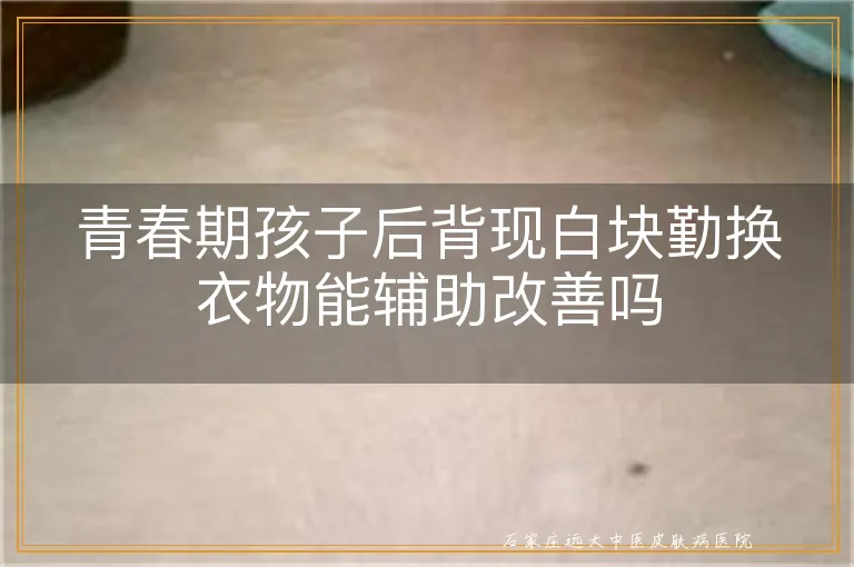 青春期孩子后背现白块勤换衣物能辅助改善吗