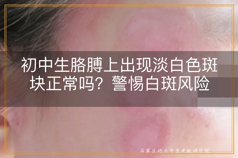 初中生胳膊上出现淡白色斑块正常吗?警惕白斑风险