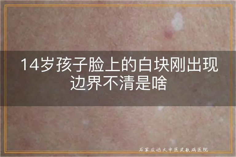 14岁孩子脸上的白块刚出现边界不清是啥