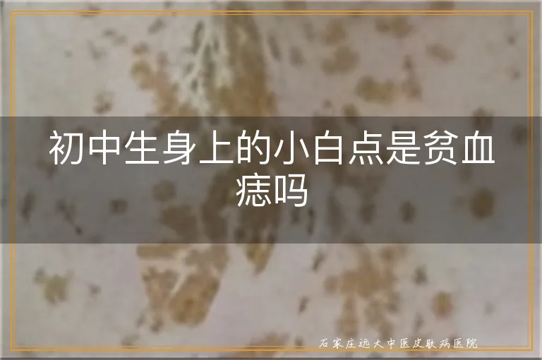 初中生身上的小白点是贫血痣吗