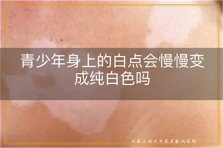 青少年身上的白点会慢慢变成纯白色吗