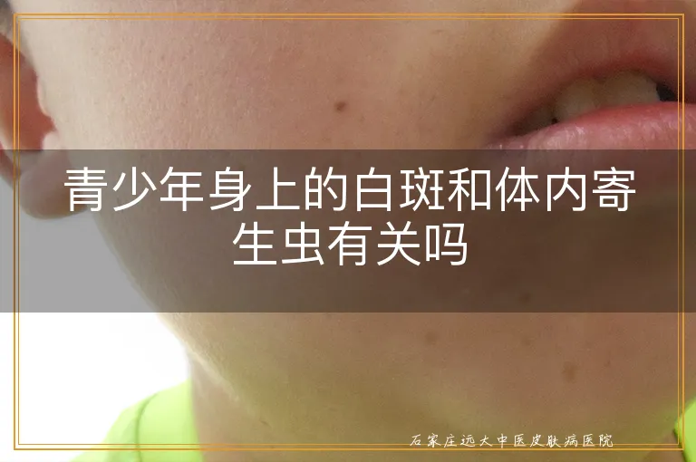 青少年身上的白斑和体内寄生虫有关吗