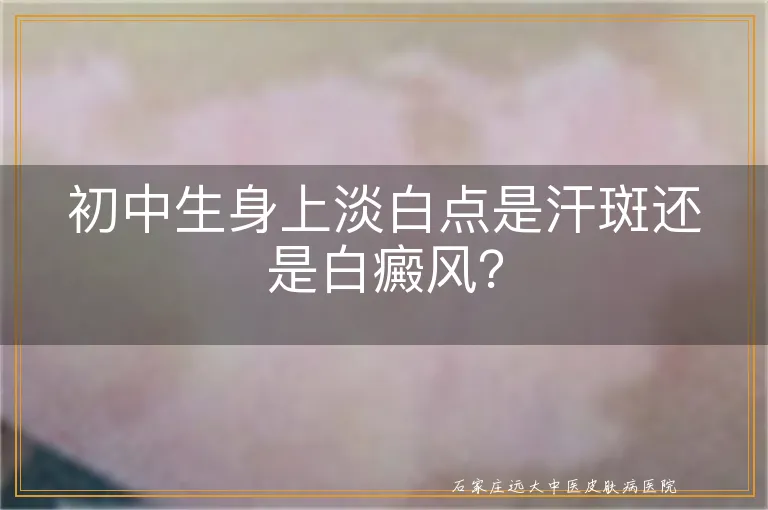 初中生身上淡白点是汗斑还是白癜风？