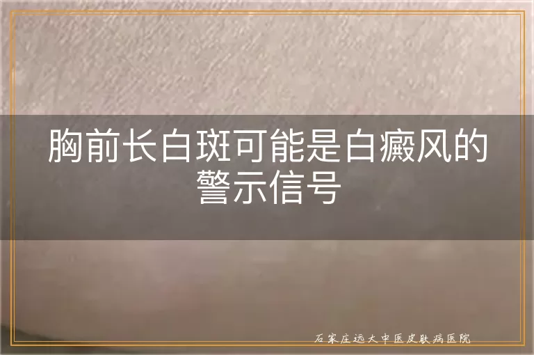 胸前长白斑可能是白癜风的警示信号