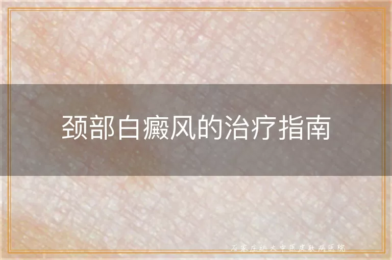 颈部白癜风的治疗指南