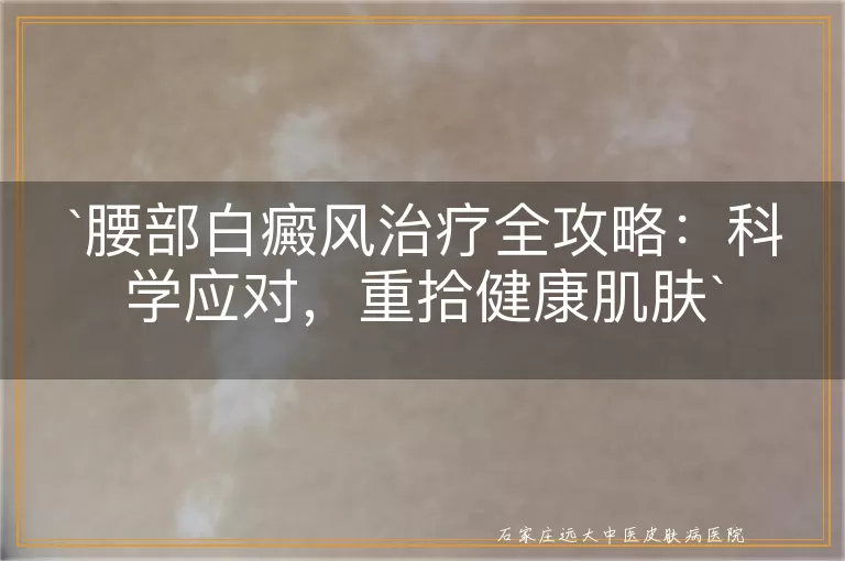 腰部白癜风治疗全攻略：科学应对，重拾健康肌肤
