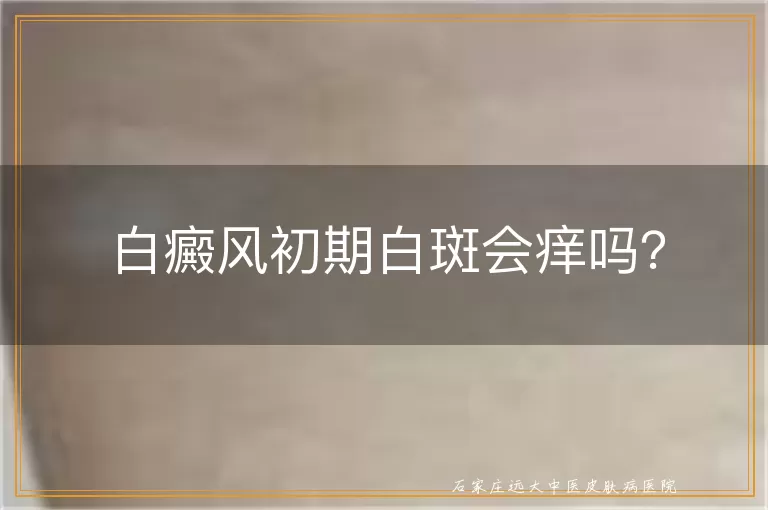 白癜风初期白斑会痒吗？