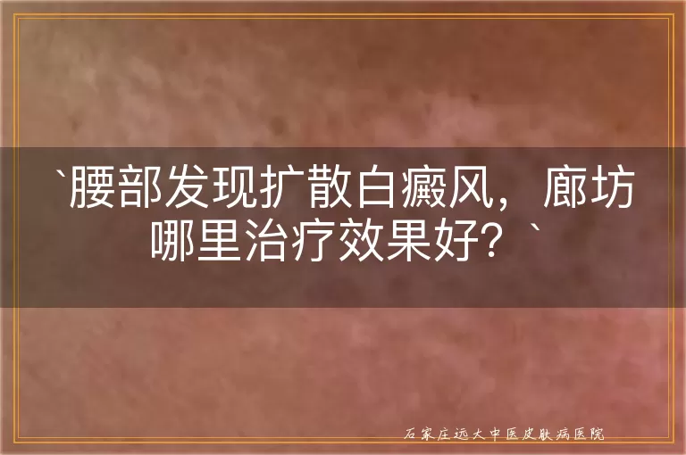 腰部发现扩散白癜风，廊坊哪里治疗效果好？