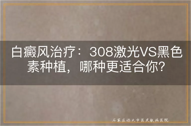 白癜风治疗：308激光VS黑色素种植，哪种更适合你？