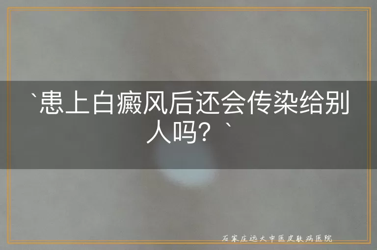 患上白癜风后还会传染给别人吗？