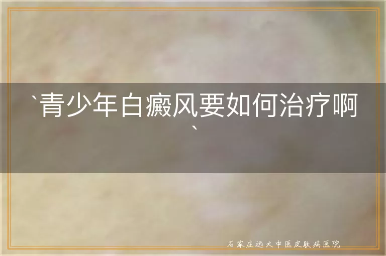 青少年白癜风要如何治疗啊