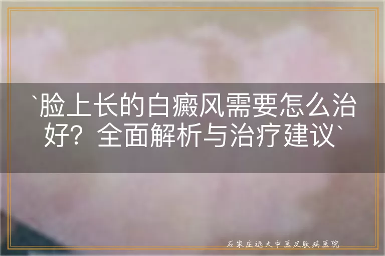 脸上长的白癜风需要怎么治好？全面解析与治疗建议