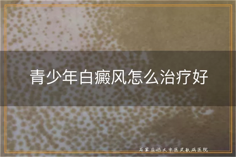 青少年白癜风怎么治疗好