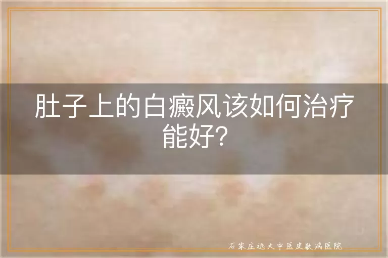 肚子上的白癜风该如何治疗能好？