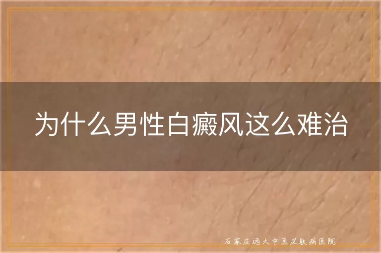 为什么男性白癜风这么难治