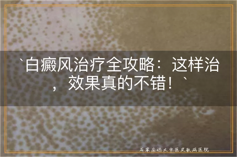 白癜风治疗全攻略：这样治，效果真的不错！