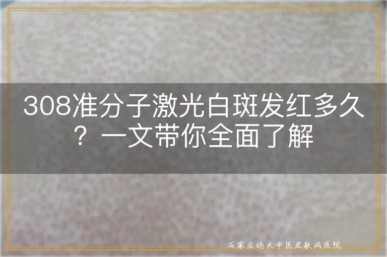 308准分子激光白斑发红多久？一文带你全面了解
