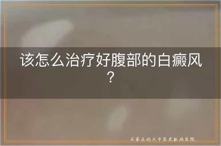 该怎么治疗好腹部的白癜风？