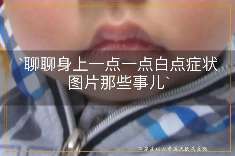 聊聊身上一点一点白点症状图片那些事儿