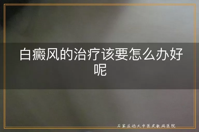 白癜风的治疗该要怎么办好呢