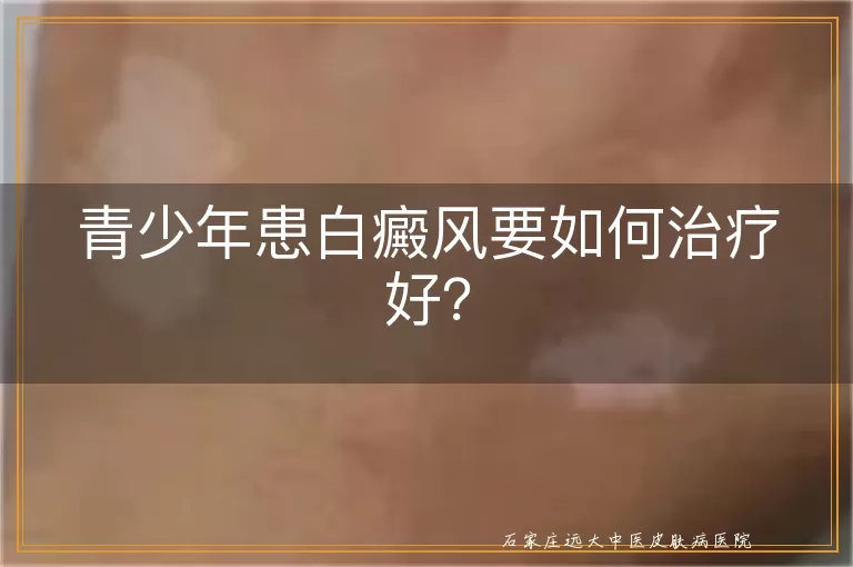 青少年患白癜风要如何治疗好？