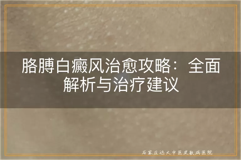 胳膊白癜风治愈攻略：全面解析与治疗建议