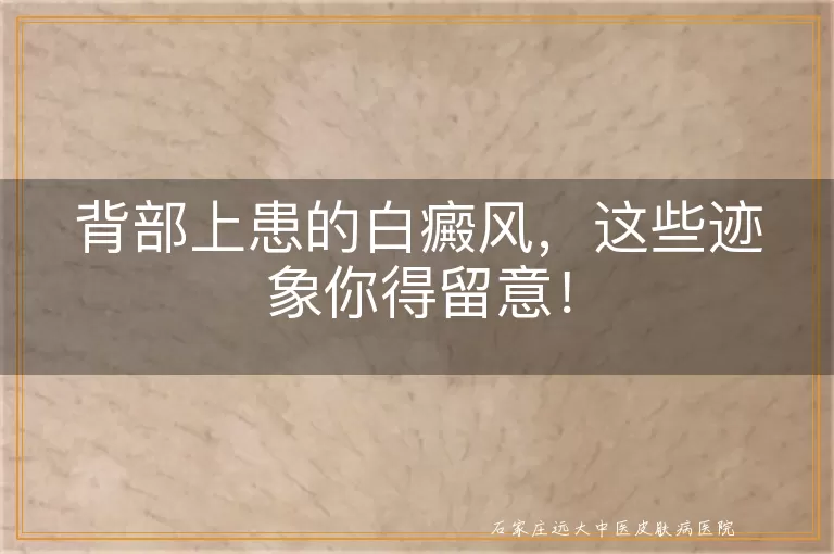 背部上患的白癜风，这些迹象你得留意！