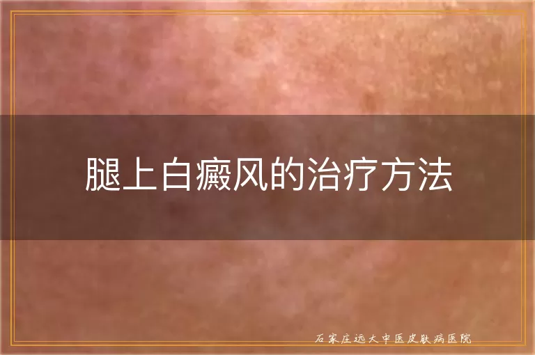 腿上白癜风的治疗方法