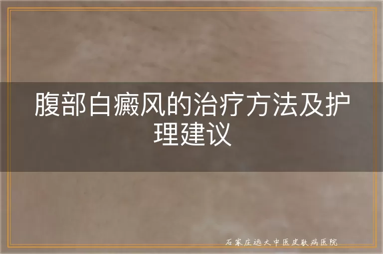 腹部白癜风的治疗方法及护理建议