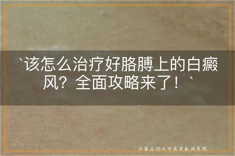 该怎么治疗好胳膊上的白癜风？全面攻略来了！