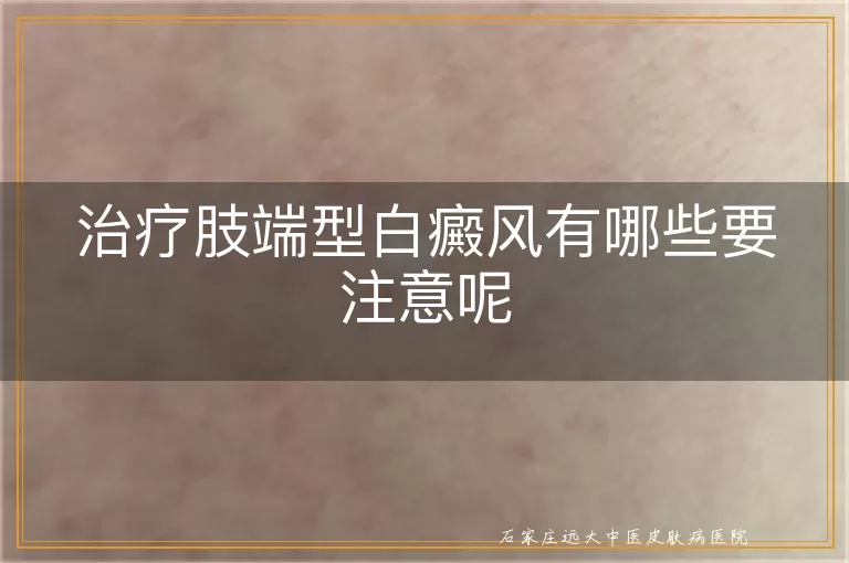 治疗肢端型白癜风有哪些要注意呢