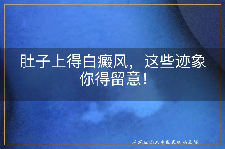 肚子上得白癜风，这些迹象你得留意！