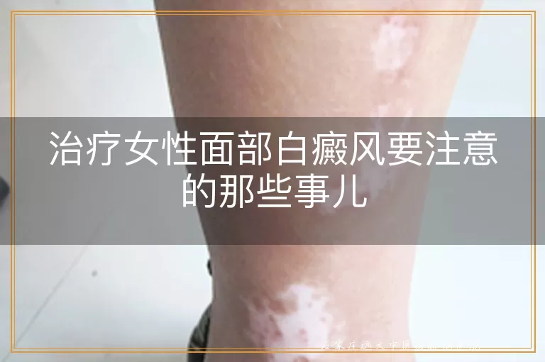 治疗女性面部白癜风要注意的那些事儿