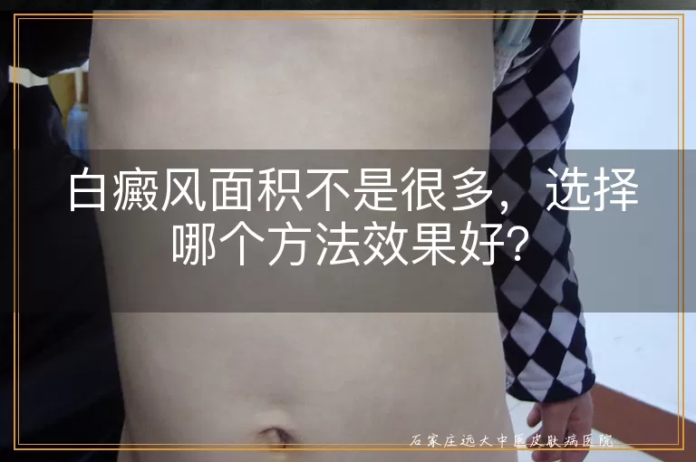 白癜风面积不是很多，选择哪个方法效果好？