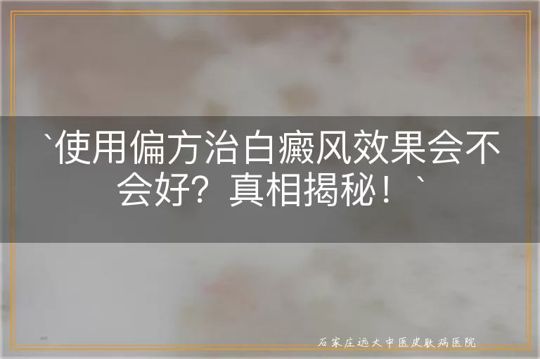 使用偏方治白癜风效果会不会好？真相揭秘！