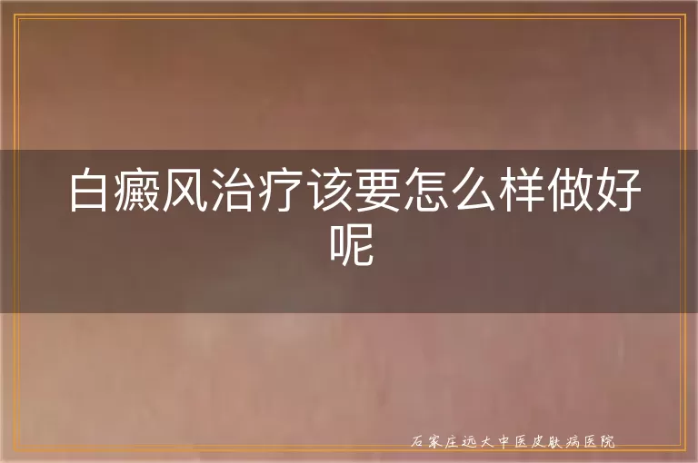 白癜风治疗该要怎么样做好呢