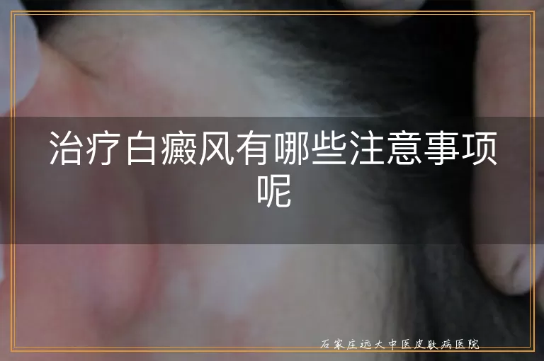 治疗白癜风有哪些注意事项呢