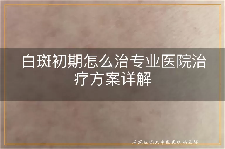 白斑初期怎么治专业医院治疗方案详解
